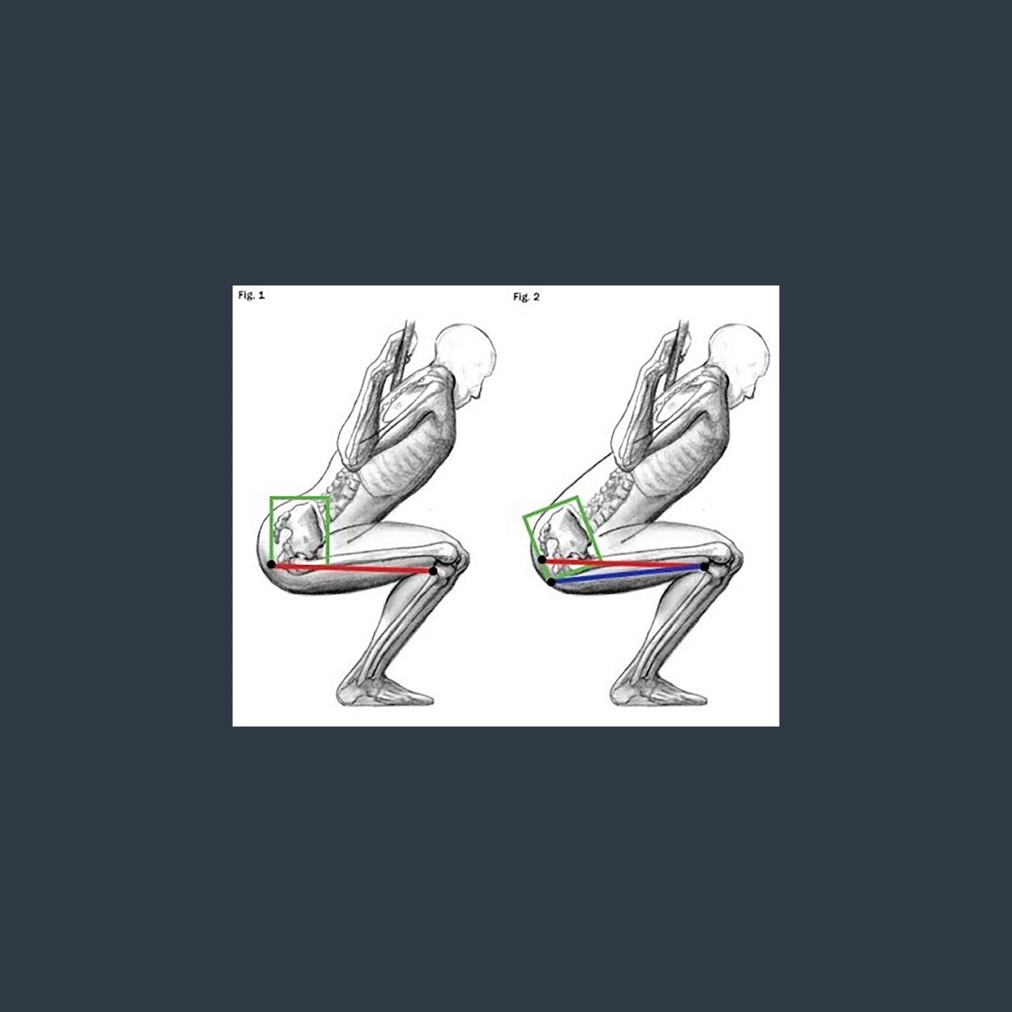 BUTT WINK by Shane Robert - Verse Fitness